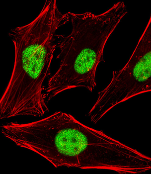 PPHLN1 Antibody (N-term)
