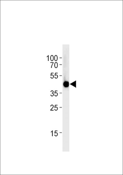 Zebrafish irf2bp2a Antibody (Center)