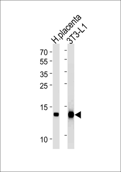 FABP4 Antibody