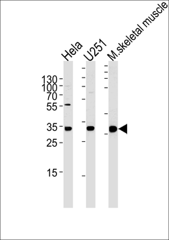 POLR2C Antibody (C-term)