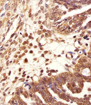 PSMB2 Antibody (C-term)