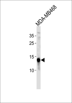 TPD52L3 Antibody (N-term)