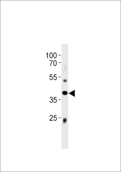 M Abi3 Antibody (C-term)