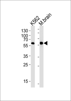 BAIAP2 Antibody (C-term)