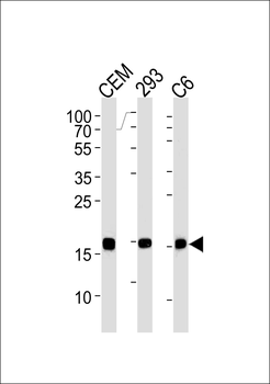 SUMO2 Antibody (C-term)