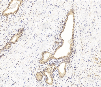 MGMT Antibody