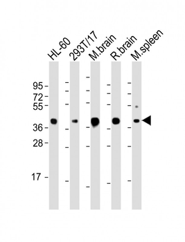 ALDOC Antibody (C-term)