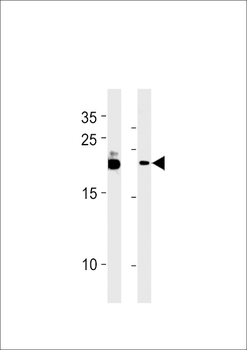 C13orf30 Antibody (C-term)