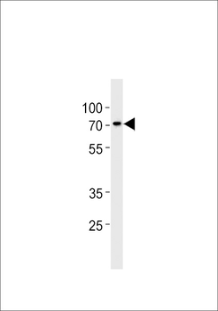 ST7L Antibody (C-term)