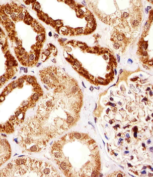 SSNA1 Antibody (N-term)