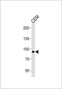 MATN2 Antibody (C-term)