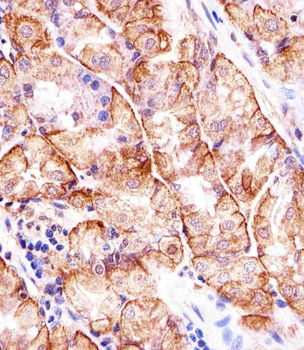 MATN2 Antibody (C-term)