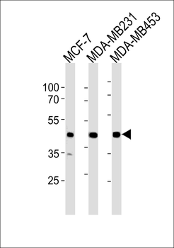 SGCG Antibody (Center)