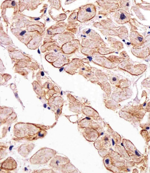 SGCG Antibody (Center)