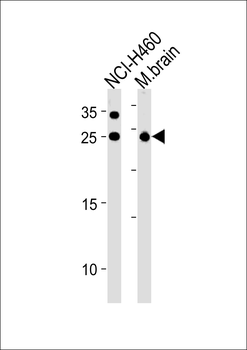 RAB3C Antibody (Center)