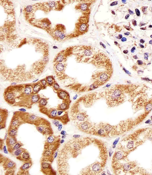 CALB1 Antibody (Center)