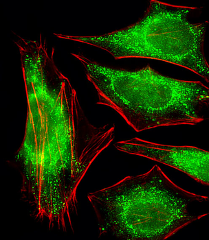 PPP2R2A Antibody (N-term)