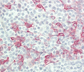 IFNA4 Antibody (C-term)
