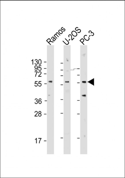 TRIM6 Antibody (N-term)
