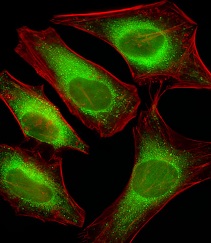 USP51 Antibody (Center)