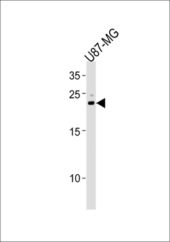 CNTF Antibody (Center)