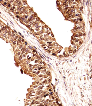 ECE2 Antibody (Center)