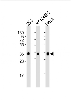 UCH37 (UCHL5) Antibody (N-term)