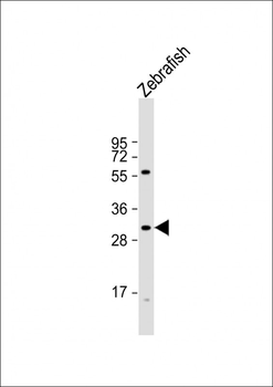 DANRE hoxd11a Antibody (Center)