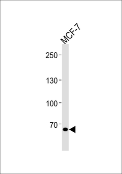 TSPYL2 Antibody (Center)