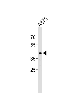 SIRPB1 Antibody (N-term)