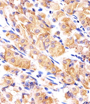 RPLP0P6 Antibody (N-term)