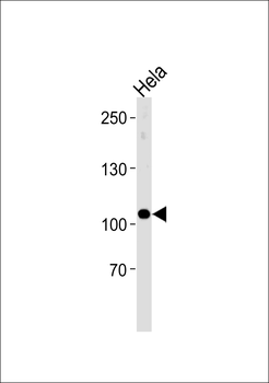 UBE3C Antibody (Center)