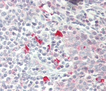 ZRSR2 Antibody (C-term)