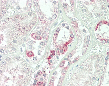 C1GALT1 Antibody (Center)
