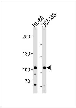 MORC3 Antibody (Center)