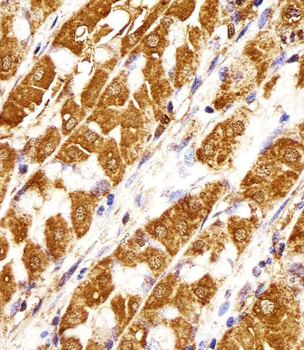 MORC3 Antibody (Center)