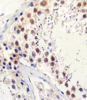 TBP Antibody