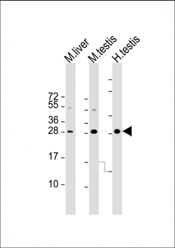CDX1 Antibody (C-term)