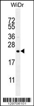 FAM237A Antibody (Center)