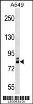 ZNF252 Antibody (N-term)