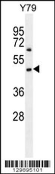 PPP2R5B Antibody (Center)