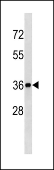 BLVRA Antibody (Center Y83)