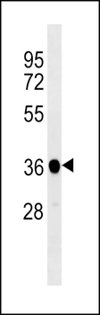 XENLA ppp1cb Antibody (C-term)