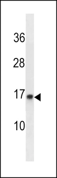 POMP Antibody (C-term)