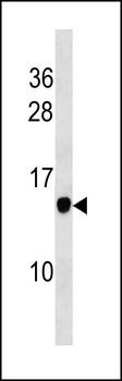 POMP Antibody (C-term)