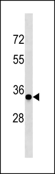CCND3 Antibody (C-term S274)