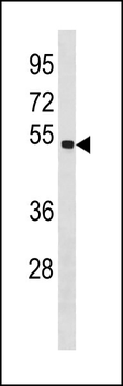 SPAG6 Antibody (C-term)