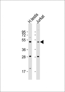 OXCT2 Antibody (Center)