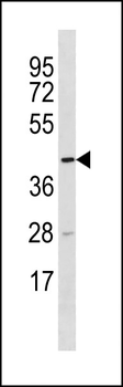 TTC5 Antibody (C-term)