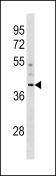 CCDC83 Antibody (N-term)